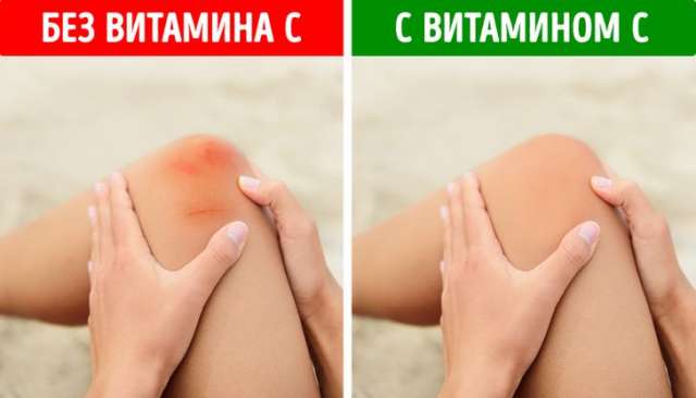 Нехватка витаминов в организме чем опасна и как ее распознать